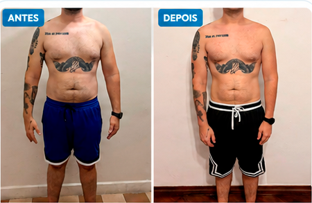 Comparação antes e depois do paciente Rafael B.